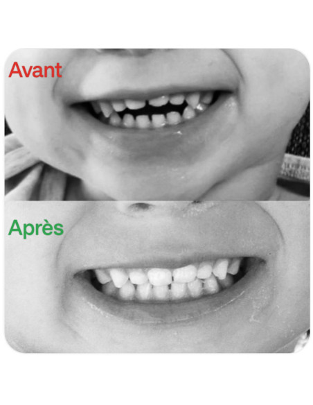 machouYou - Fini le pouce et la tétine!